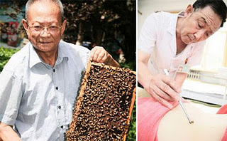 Bee Venom Therapy a Popular Chinese Treatment for MS, Arthritis, Shingles