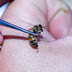 Stop Wrinkles with a Bee Sting