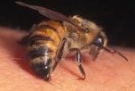 Treating Multiple Sclerosis with Bee Venom Therapy