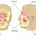 Manuka Honey Can Help Treat Chronic Rhinosinusitis, MRSA