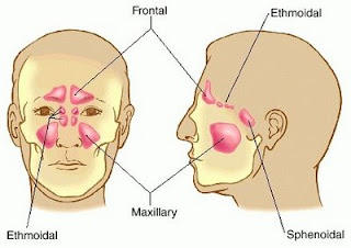 Manuka Honey Can Help Treat Chronic Rhinosinusitis, MRSA