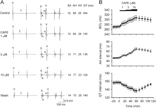 Propolis Component Exhibits Cardioprotective, Antiarrhythmic Effects