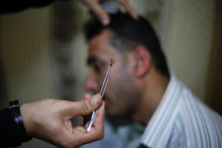Hearing Impaired Palestinian Receives Treatment at a Bee Venom Therapy Center in Gaza City