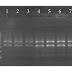 Polish Propolis Reduces Bacterial Biofilm Formation