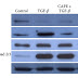 Propolis Component Inhibits Growth of Pancreatic Cancer Cells