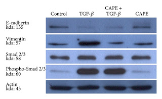 Propolis Component Inhibits Growth of Pancreatic Cancer Cells