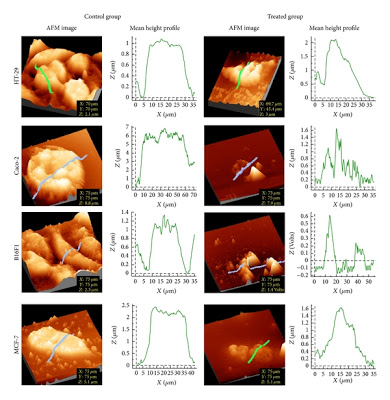 Indian Stingless Bee Propolis Demonstrates Anticancer Activity