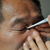 Bee Sting Therapy Causing a Buzz in China